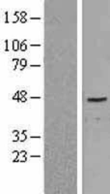 Western Blot: LRH-1/NR5A2 Overexpression Lysate [NBP2-04258]