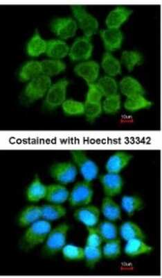 Immunocytochemistry/ Immunofluorescence: CLC Antibody [NBP2-19580]