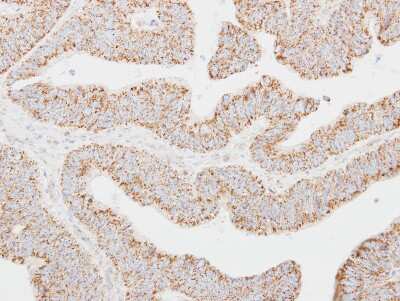 Immunohistochemistry-Paraffin: CLC Antibody [NBP2-19580]