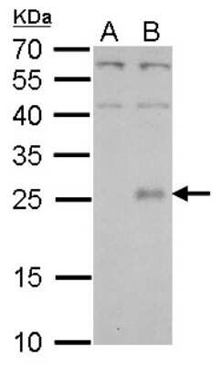 Western Blot: CLC Antibody [NBP2-19580]