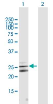 Western Blot: CLC Antibody [H00023529-B03P]