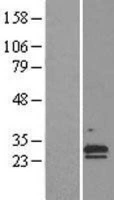 Western Blot: CLC Overexpression Lysate [NBL1-09231]