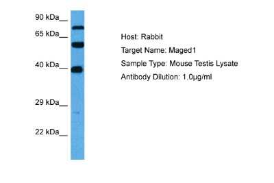 Western Blot: NRAGE/MAGED1 Antibody [NBP1-98411]