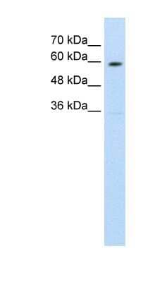 Western Blot: NRAMP1/SLC11A1 Antibody [NBP1-59785]