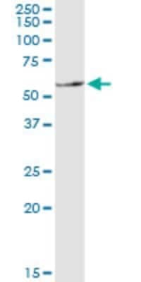 Western Blot: NRAMP1/SLC11A1 Antibody (2G2) [H00006556-M01]