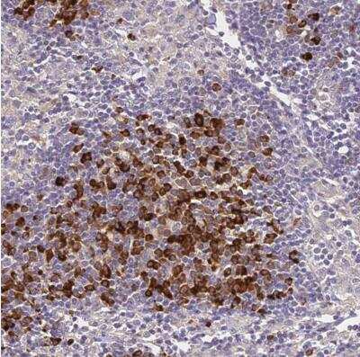 Immunohistochemistry-Paraffin: NRAMP1/SLC11A1 Antibody [NBP1-87809]