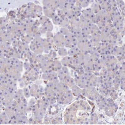 Immunohistochemistry-Paraffin: NRAMP1/SLC11A1 Antibody [NBP1-87809]