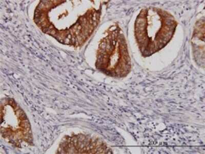Immunohistochemistry-Paraffin: NRAMP2/SLC11A2/DMT1 Antibody (4C6) [H00004891-M01]