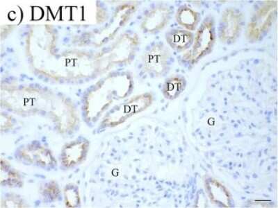 Immunohistochemistry-Paraffin: NRAMP2/SLC11A2/DMT1 Antibody (4C6) [H00004891-M01]