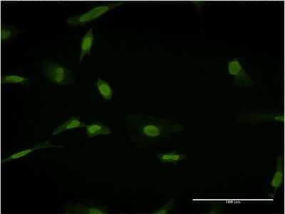 Immunocytochemistry/ Immunofluorescence: NRAMP2/SLC11A2/DMT1 Antibody (4G2) [H00004891-M03]