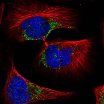 Immunocytochemistry/ Immunofluorescence: NRAMP2/SLC11A2/DMT1 Antibody [NBP1-91841]