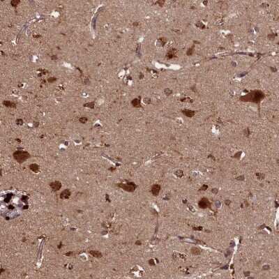 Immunohistochemistry-Paraffin: NRAMP2/SLC11A2/DMT1 Antibody [NBP1-91841]