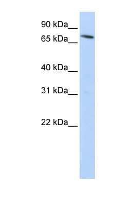 Western Blot: NRAMP2/SLC11A2/DMT1 Antibody [NBP1-59869]