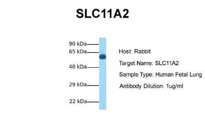 Western Blot: NRAMP2/SLC11A2/DMT1 Antibody [NBP1-59869]