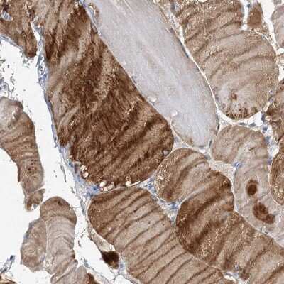 Immunohistochemistry: NRAP Antibody [NBP2-32650]
