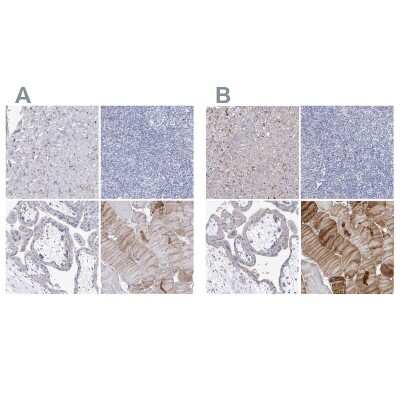 Immunohistochemistry-Paraffin: NRAP Antibody [NBP1-86267]