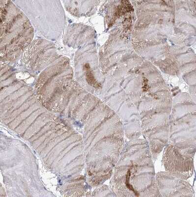 Immunohistochemistry-Paraffin: NRAP Antibody [NBP1-86267]