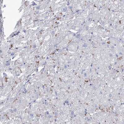 Immunohistochemistry-Paraffin: NRAP Antibody [NBP1-86267]