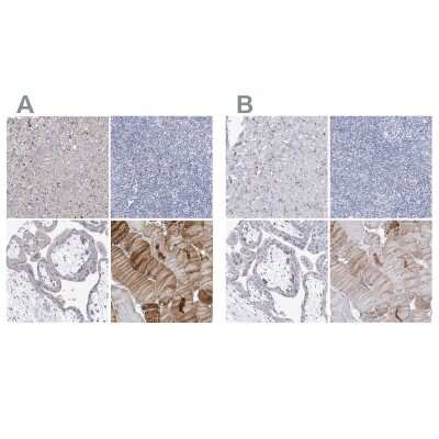 Immunohistochemistry-Paraffin: NRAP Antibody [NBP2-32650]