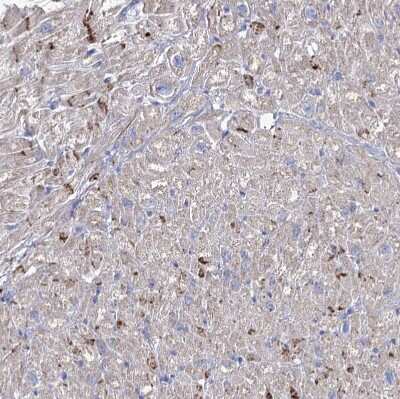 Immunohistochemistry-Paraffin: NRAP Antibody [NBP2-32650]