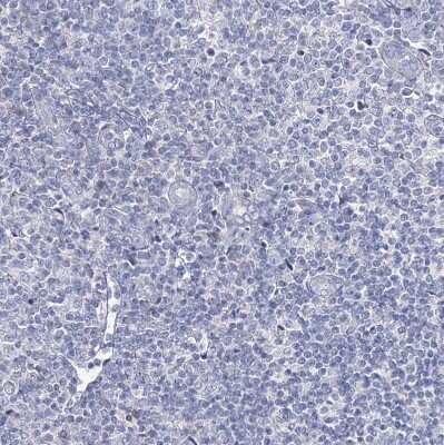 Immunohistochemistry-Paraffin: NRAP Antibody [NBP2-32650]