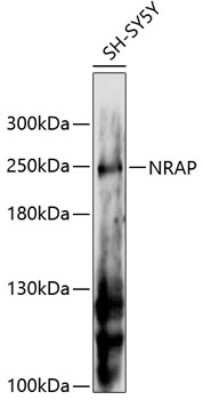 Western Blot: NRAP AntibodyAzide and BSA Free [NBP2-93285]