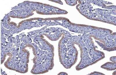 Immunohistochemistry-Paraffin: NRARP Antibody [NBP1-82665]