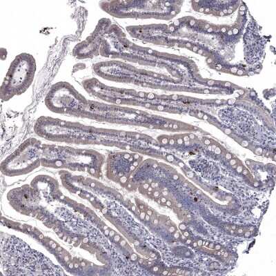 Immunohistochemistry-Paraffin: NRARP Antibody [NBP1-82665]