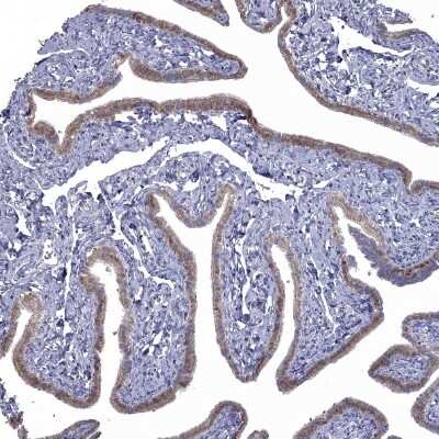 Immunohistochemistry-Paraffin: NRARP Antibody [NBP1-82665]