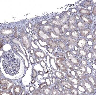 Immunohistochemistry-Paraffin: NRARP Antibody [NBP1-82665]