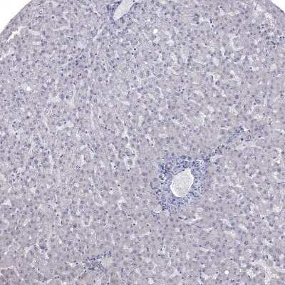 Immunohistochemistry-Paraffin: NRARP Antibody [NBP1-82665]