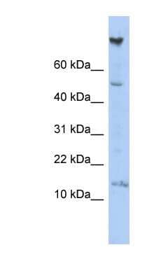 Western Blot: NRARP Antibody [NBP1-56421]