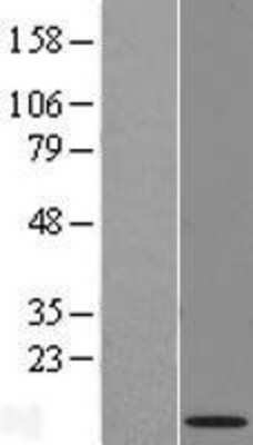 Western Blot: NRARP Overexpression Lysate [NBL1-13784]