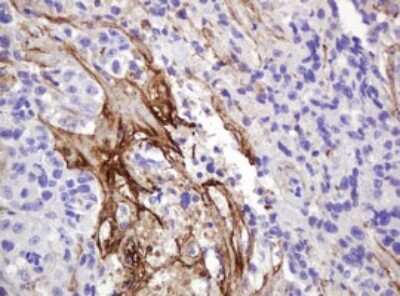 Immunohistochemistry: NRAS Antibody (OTI5G7) [NBP2-45860]