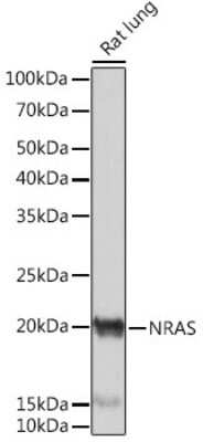 Western Blot: NRAS Antibody (6S6F3) [NBP3-16473]