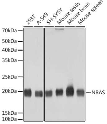 Western Blot: NRAS Antibody (6S6F3) [NBP3-16473]
