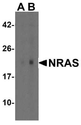 Western Blot: NRAS AntibodyBSA Free [NBP2-81861]