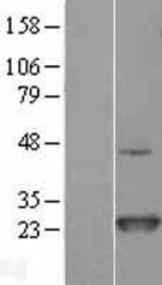 Western Blot: NRAS Overexpression Lysate [NBL1-13785]