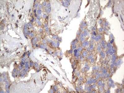 Immunohistochemistry: NRBF2 Antibody (OTI1A2) [NBP2-46258]