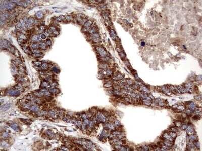 Immunohistochemistry: NRBF2 Antibody (OTI1A2) [NBP2-46258]
