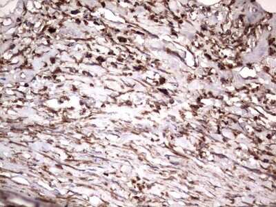 Immunohistochemistry: NRBF2 Antibody (OTI1A2) [NBP2-46258]