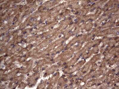 Immunohistochemistry: NRBF2 Antibody (OTI1A2) [NBP2-46258]