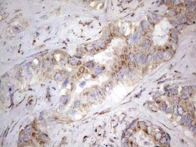 Immunohistochemistry: NRBF2 Antibody (OTI1A2) [NBP2-46258]
