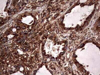 Immunohistochemistry: NRBF2 Antibody (OTI1A2) [NBP2-46258]