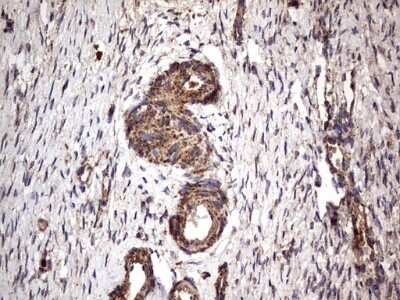 Immunohistochemistry: NRBF2 Antibody (OTI1A2) [NBP2-46258]