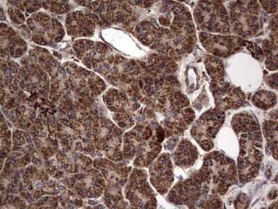 Immunohistochemistry: NRBF2 Antibody (OTI1A2) [NBP2-46258]