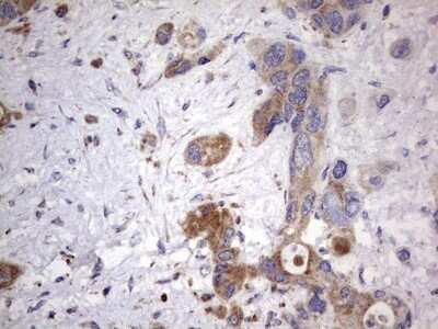 Immunohistochemistry: NRBF2 Antibody (OTI1A2) [NBP2-46258]