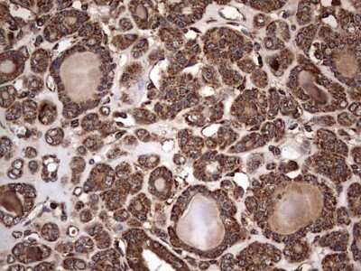 Immunohistochemistry: NRBF2 Antibody (OTI1A2) [NBP2-46258]