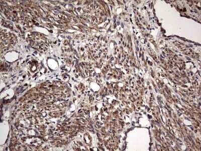 Immunohistochemistry: NRBF2 Antibody (OTI1A2) [NBP2-46258]