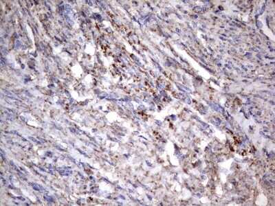 Immunohistochemistry: NRBF2 Antibody (OTI1A2) [NBP2-46258]